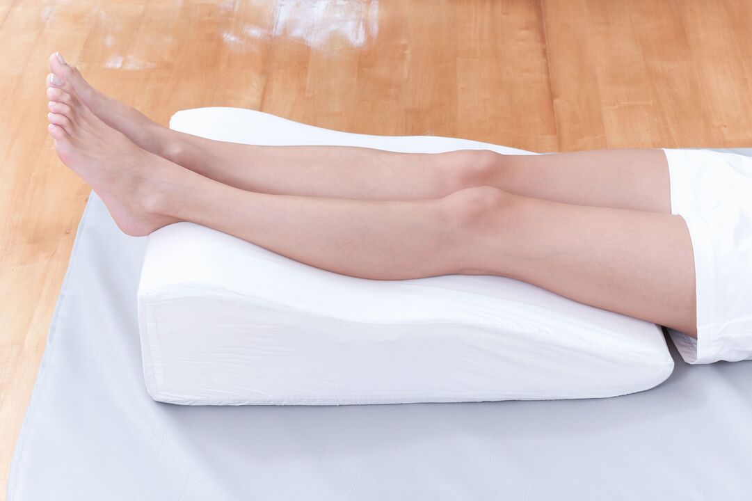 Prevenção de veias varicosas