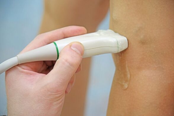 Ultrassom das veias