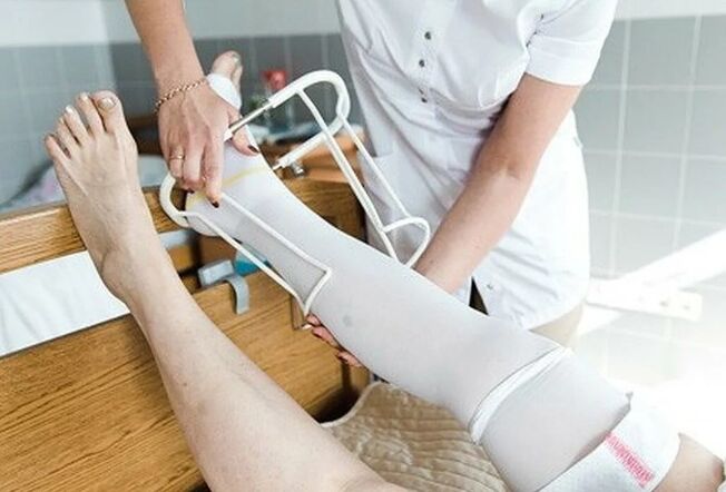 Período pós -operatório da cirurgia nas veias das pernas