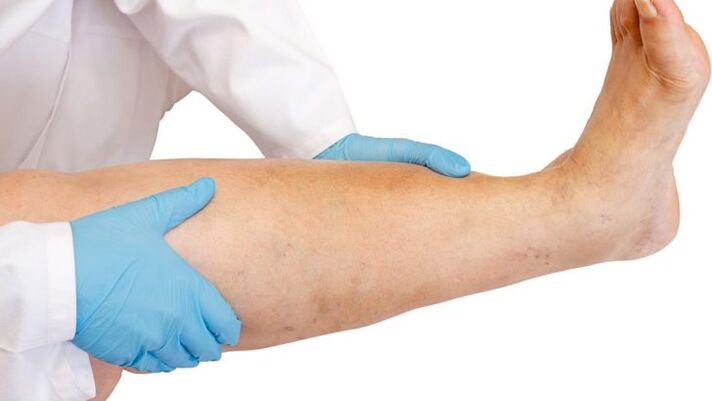 como identificar a doença